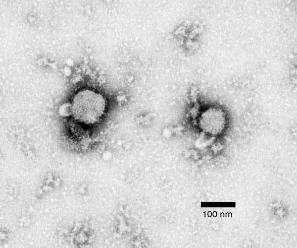 Tikus Bisa Menyebabkan 5 Penyakit Berbahaya ini! 6 Lymphocytic Choriomeningitis Virus