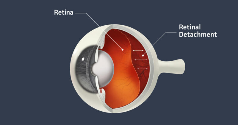 5 Manfaat Luar Biasa Saffron Bagi Kesehatan, Wajar Harganya Mahal 7 Manfaat Saffron Untuk Menjaga Retina Mata