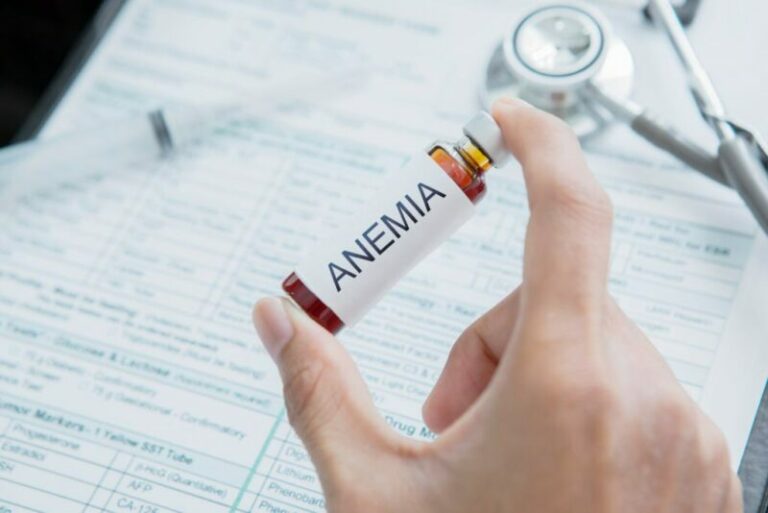 Cara Mengatasi Anemia Dengan Mudah
