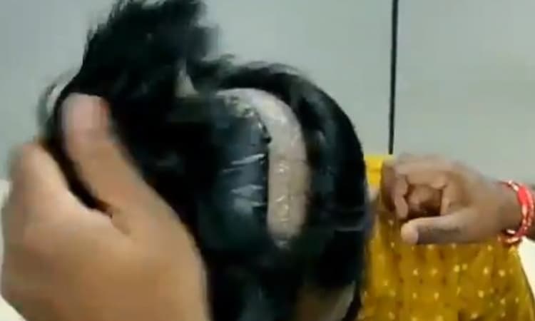 Bergaya Rambut Nyentrik, Pria ini Ditangkap Karena Selundupkan Emas 680 Gram 6 Pria Selundupkan Emas Pada Rambutnya